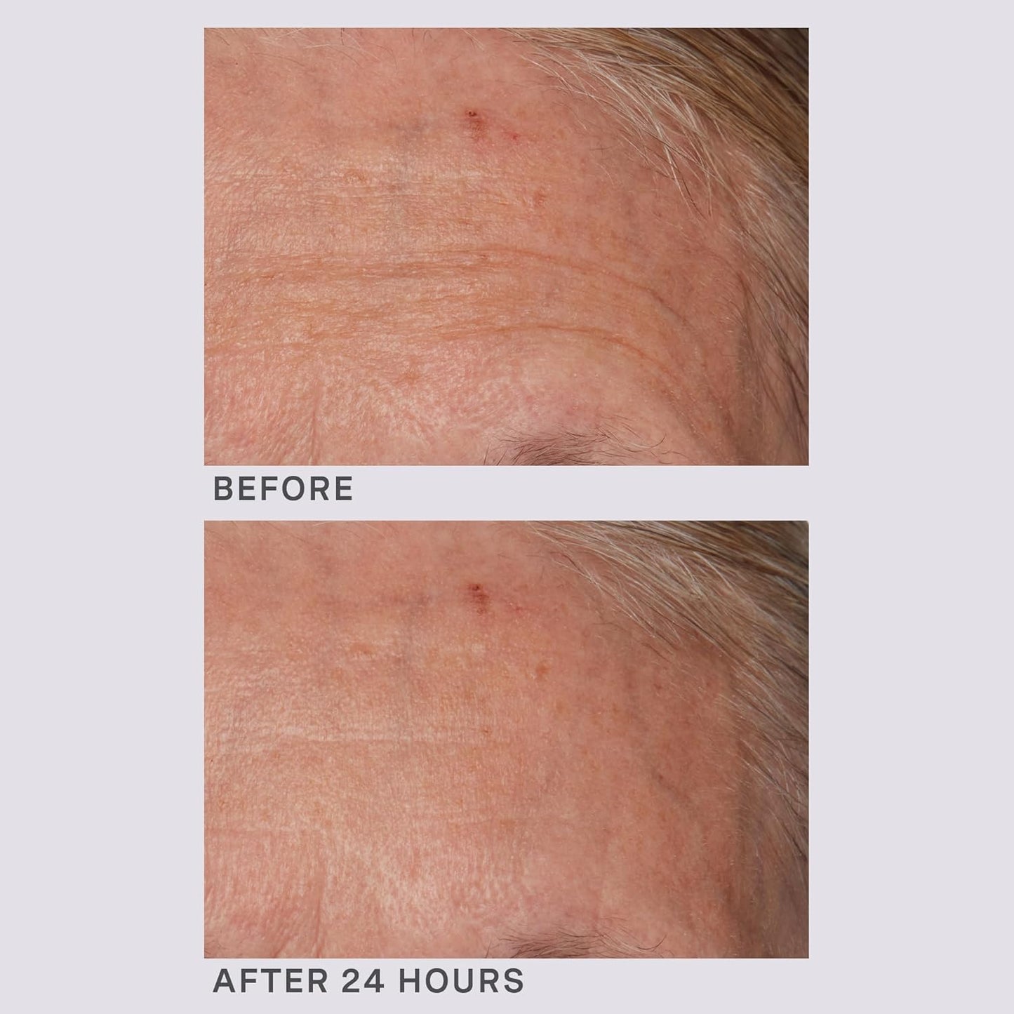 Lancer Gravity Defying Moisturizer With Firming Technology, Face Moisturizer for Women, Great at Boosting Collagen, Hydration, Anti-Aging and Firmness