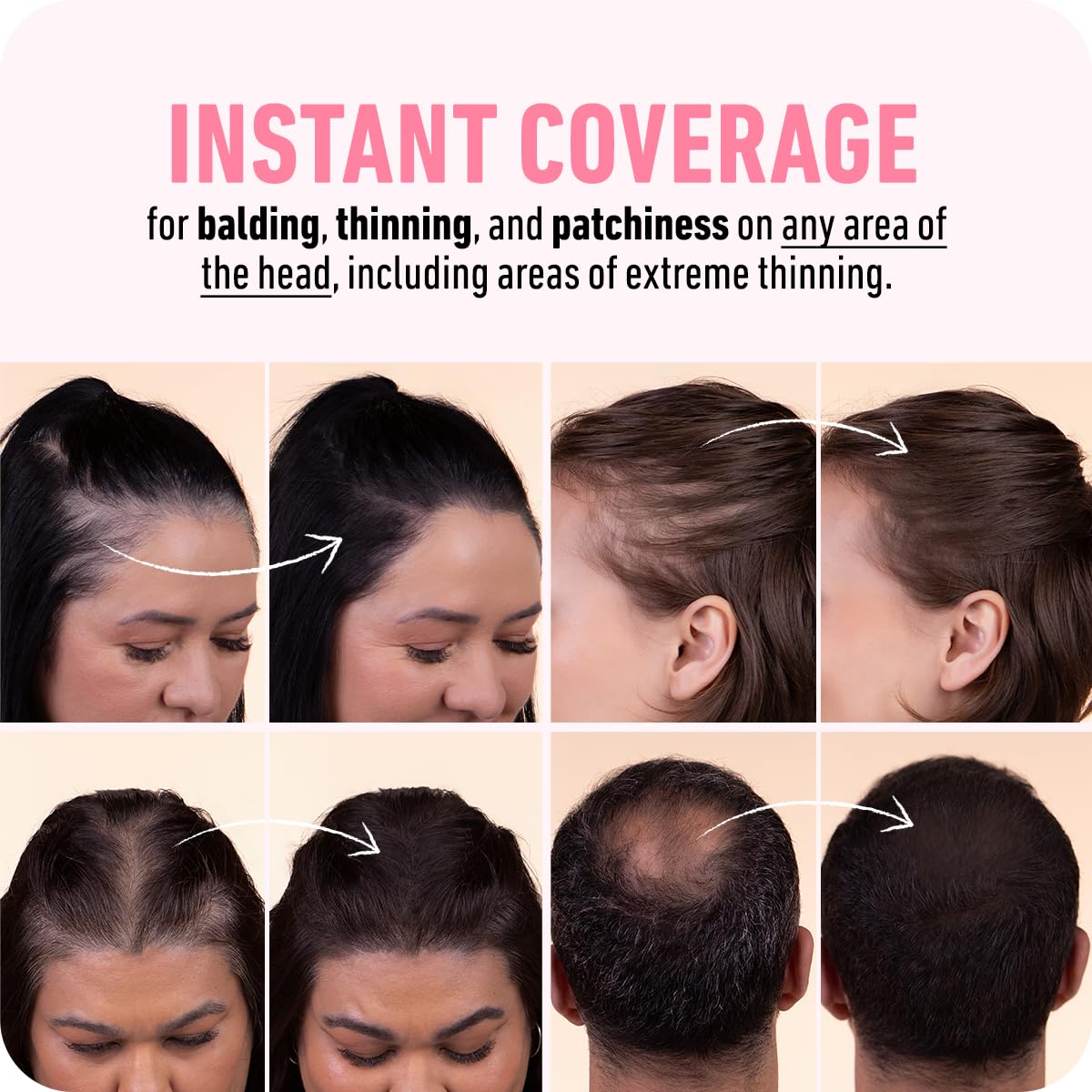 BOLDIFY Hairline Powder (LARGE, 10g) - Root Touch Up Hair Color for Gray Coverage - Bald Spot Concealing Hair Powder for Women & Men - 48-Hour Stain-Proof - Light Brown