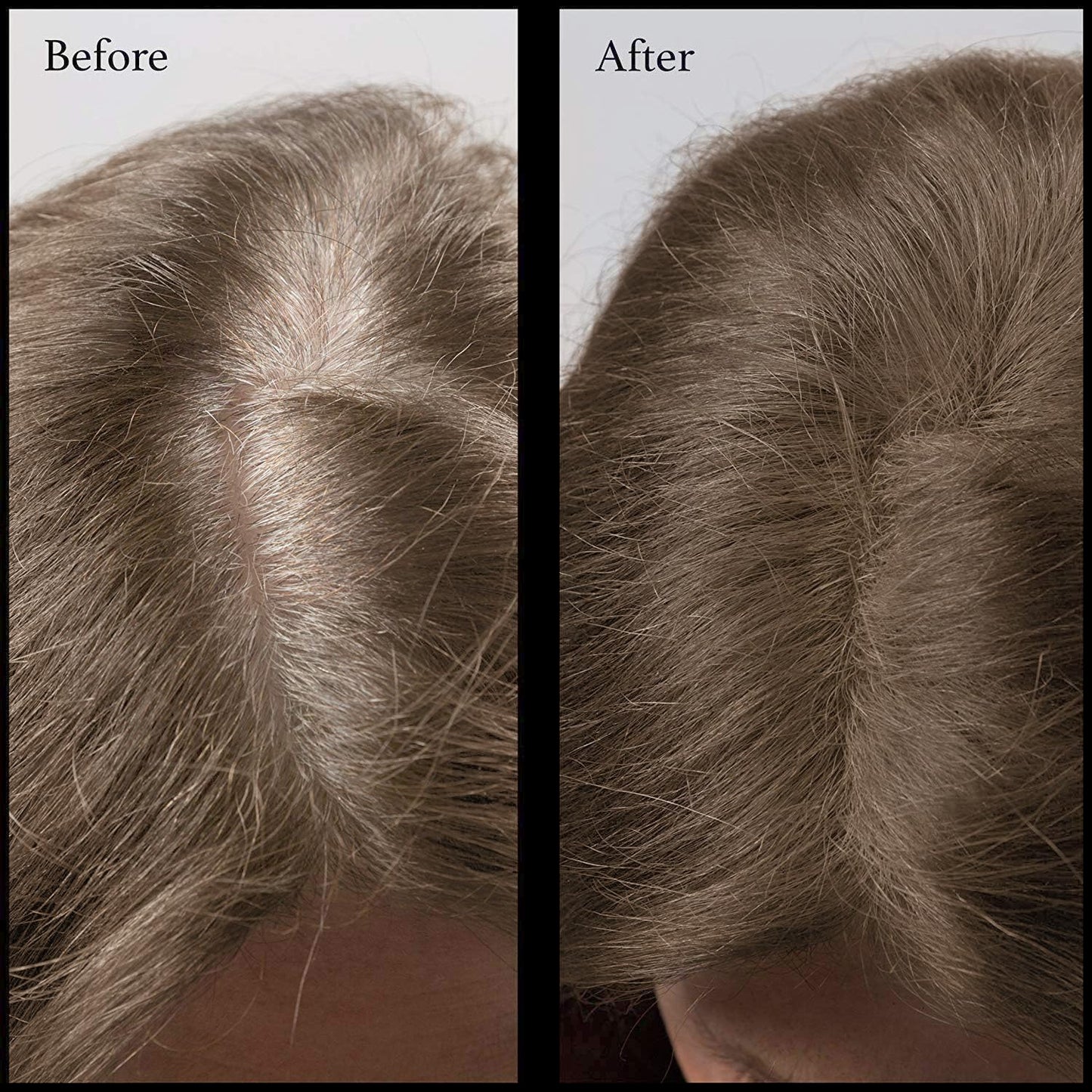 Hair Root Touch Up Powder, Light Brown - 11 True-to-Nature Root Concealer Shades, Long-lasting, Fragrance, Talc, Parabens Free, With Brush